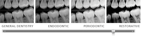 Presets for general dentistry, endodontics, periodontics or restorative dentistry